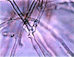 Myzel eines Basidiomyceten